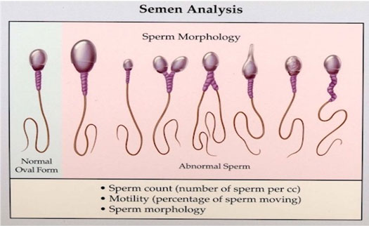 Semen Analysis